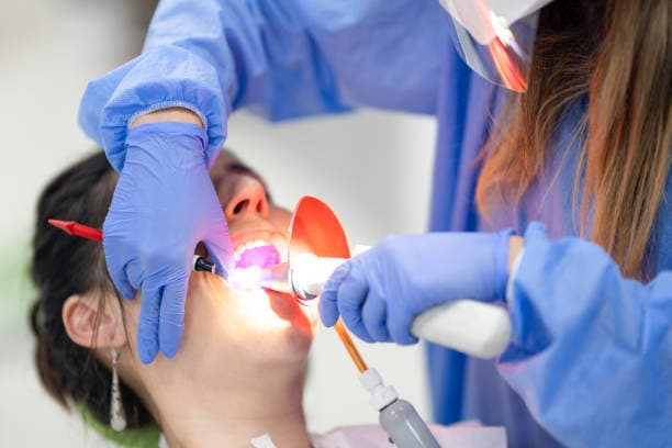 Sealants at Green Valley Dental in Fairfield, CA