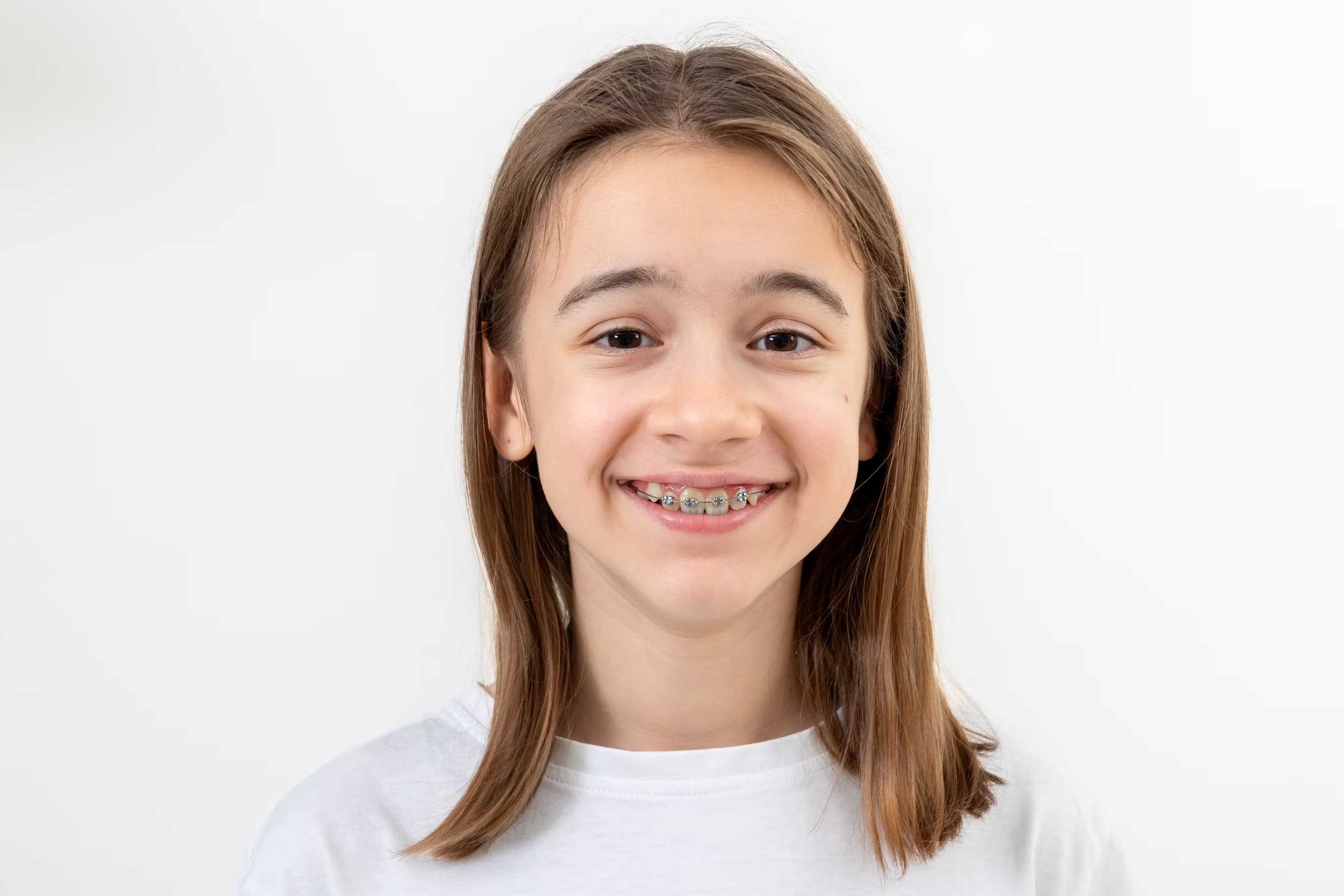 Children & Orthodontics at Green Valley Dental in Fairfield, CA