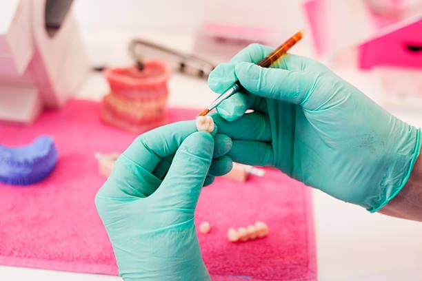 Crowns at Green Valley Dental in Fairfield, CA