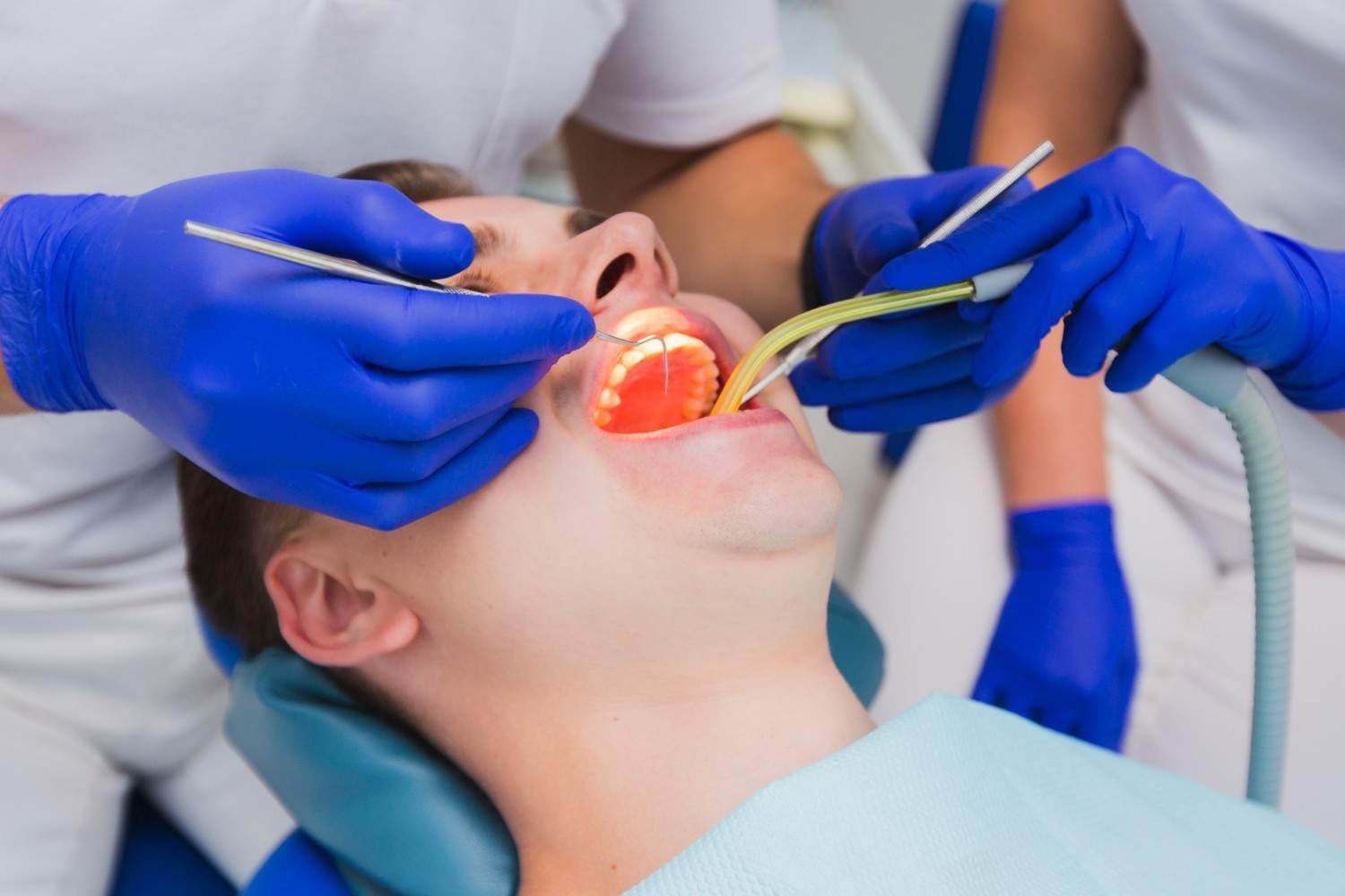 Endodontics at Green Valley Dental in Fairfield, CA