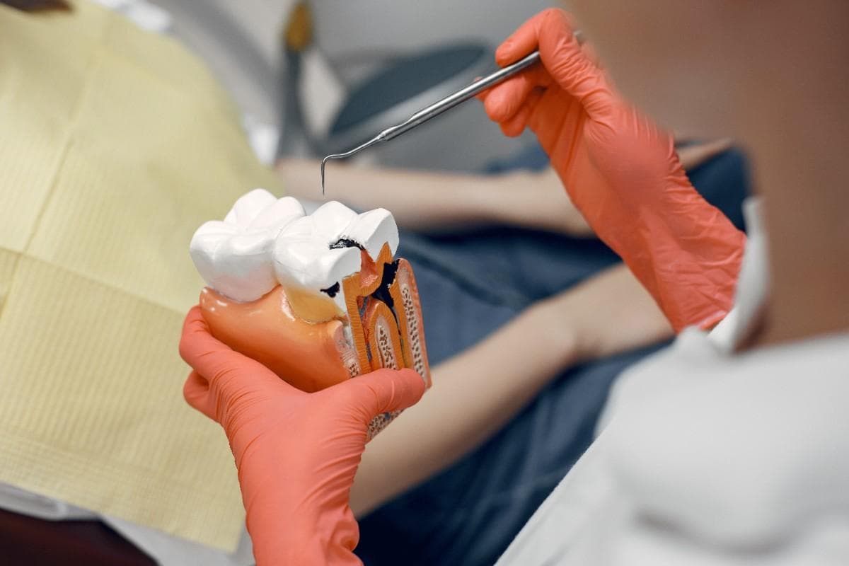 Root Canal Therapy at Green Valley Dental in Fairfield, CA