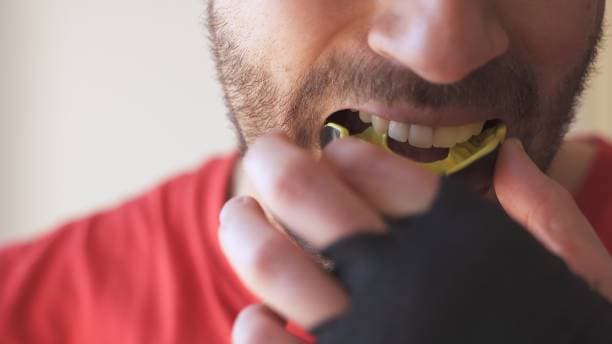 Sports Mouthguards at Green Valley Dental in Fairfield, CA