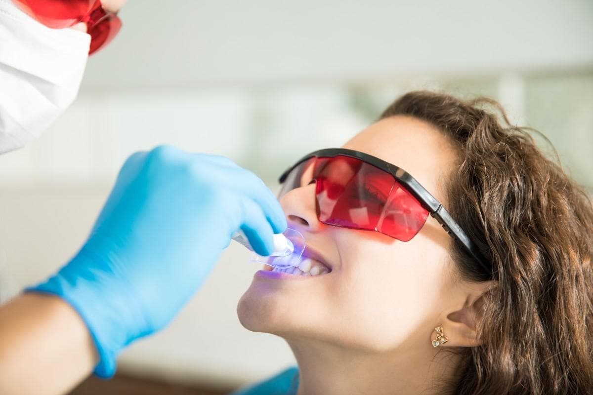 Teeth Whitening at Green Valley Dental in Fairfield, CA